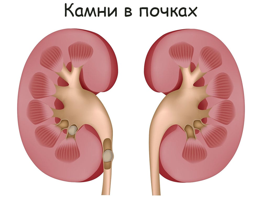Kra10.cc